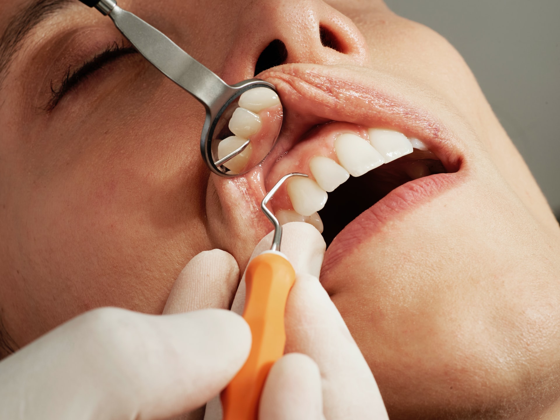 Ползите от редовното почистване на зъбите и зъболекарските прегледи